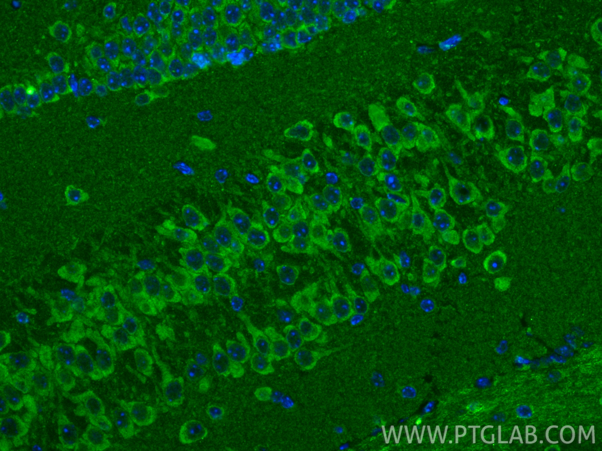 IF Staining of mouse brain using 68787-3-Ig IF Staining of mouse brain using 68787-3-Ig