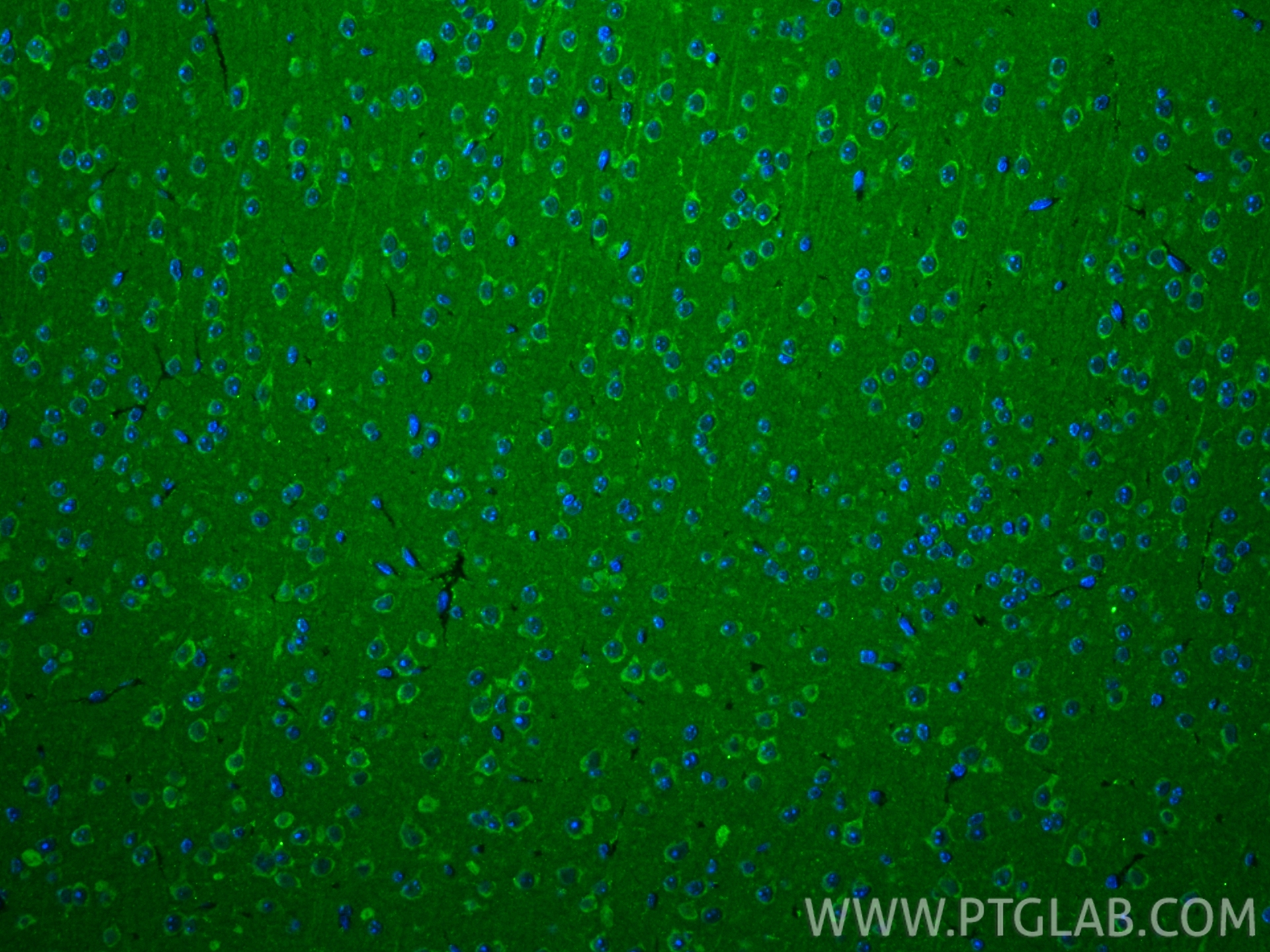 IF Staining of mouse brain using 82771-1-RR IF Staining of mouse brain using 82771-1-RR