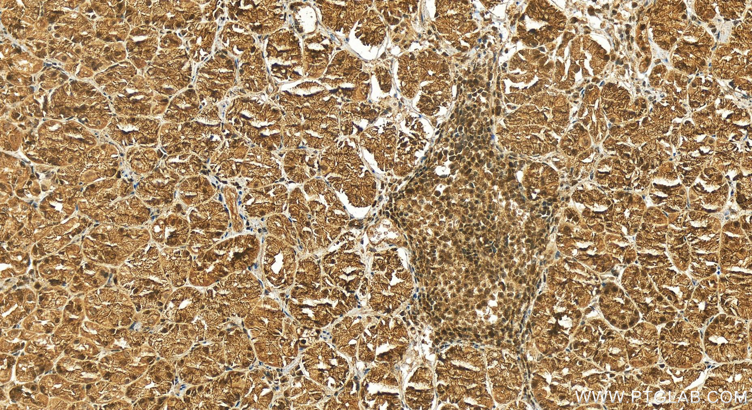 IHC staining of human stomach using 16132-1-AP