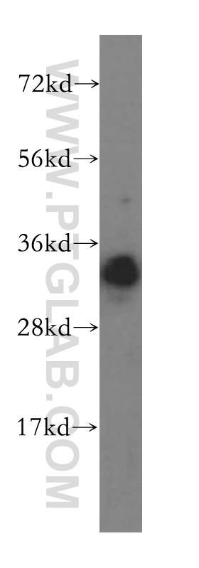 WB analysis of human liver using 16132-1-AP