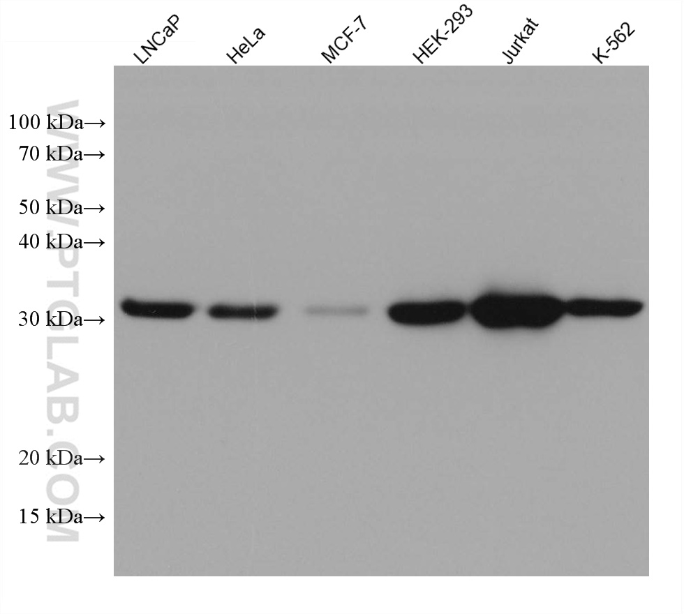 WB analysis using 67976-1-Ig