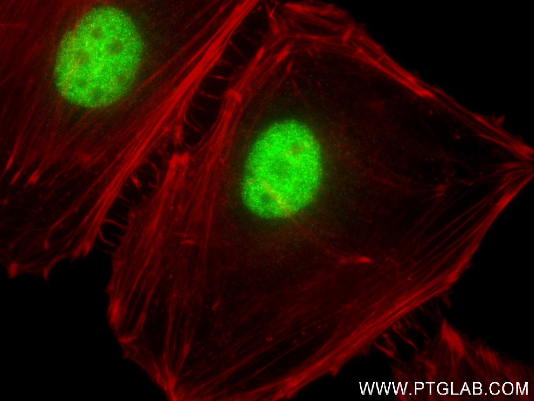 IF Staining of HeLa using 84097-6-RR (same clone as 84097-6-PBS)