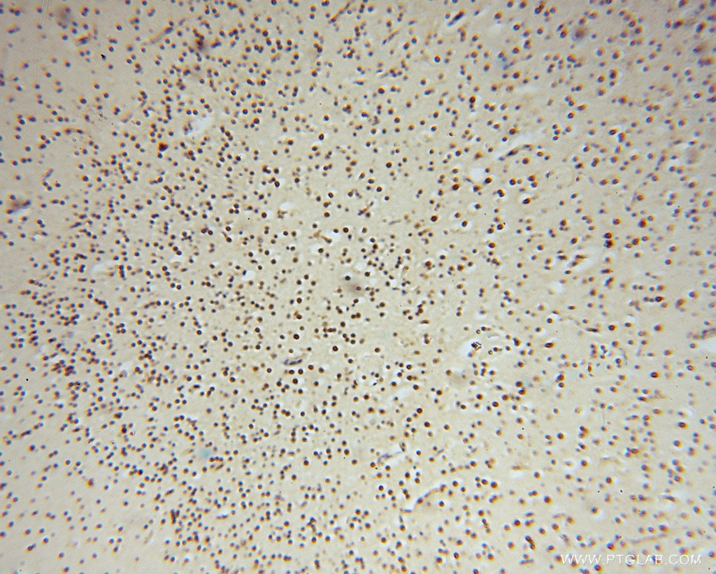 IHC staining of human brain using 16518-1-AP