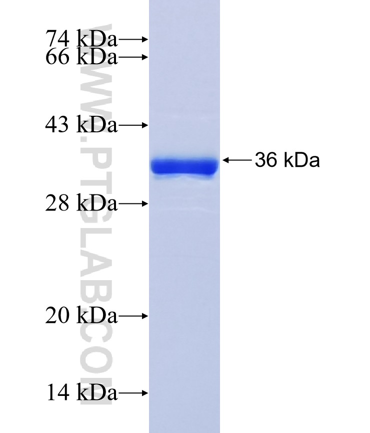 RNASET2 fusion protein Ag36600 SDS-PAGE RNASET2 fusion protein Ag36600 SDS-PAGE