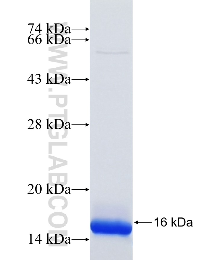 RNASET2 fusion protein Ag36625 SDS-PAGE RNASET2 fusion protein Ag36625 SDS-PAGE