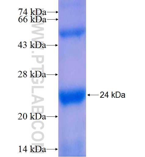 RND2 fusion protein Ag4972 SDS-PAGE RND2 fusion protein Ag4972 SDS-PAGE