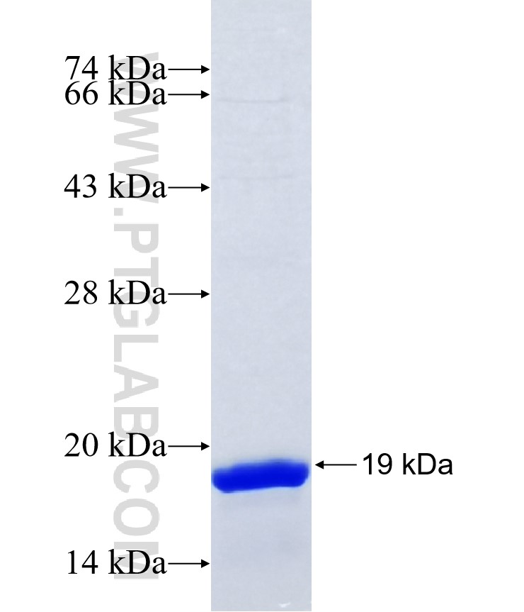 RND3 fusion protein Ag39708 SDS-PAGE RND3 fusion protein Ag39708 SDS-PAGE