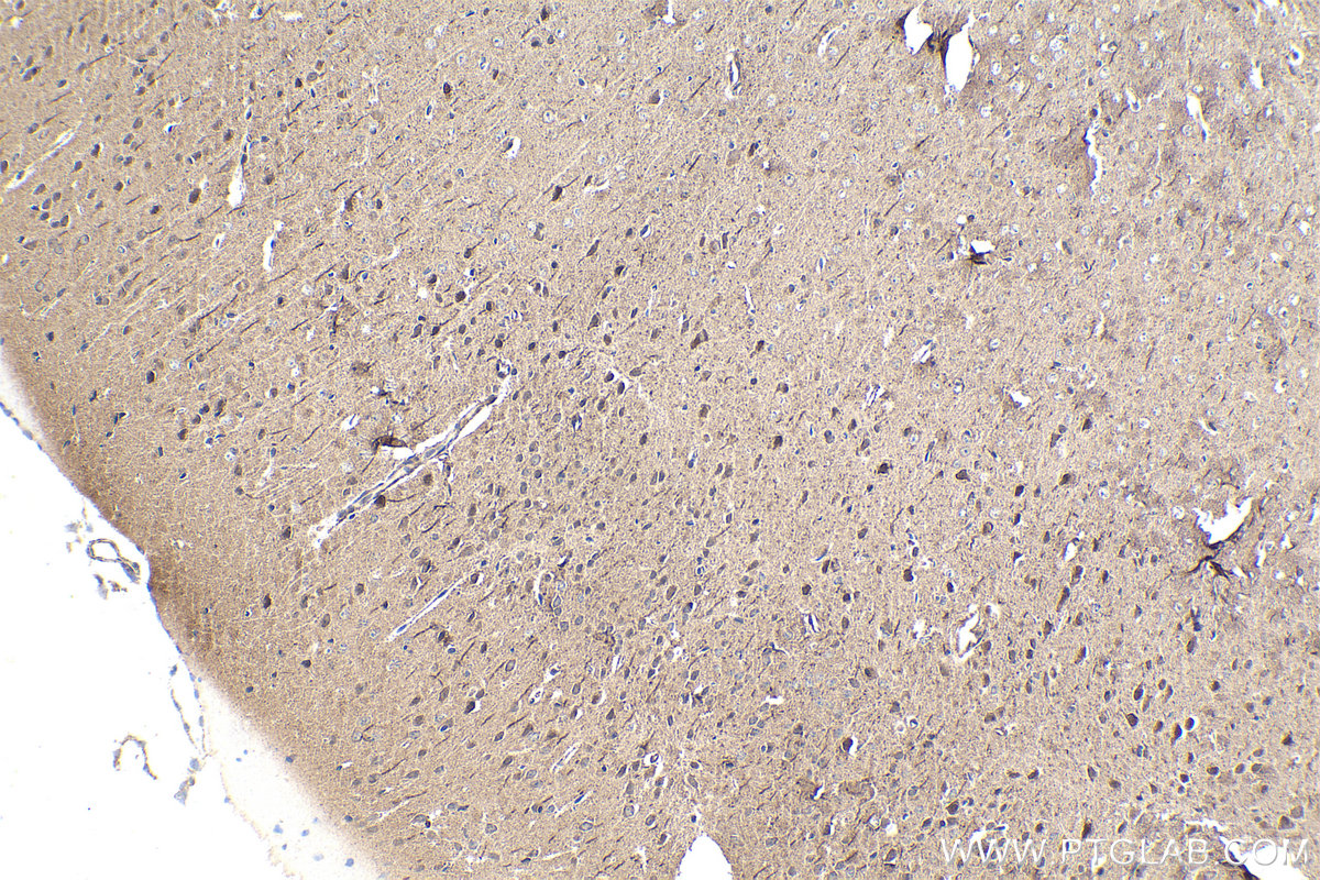 IHC staining of mouse brain using 16936-1-AP