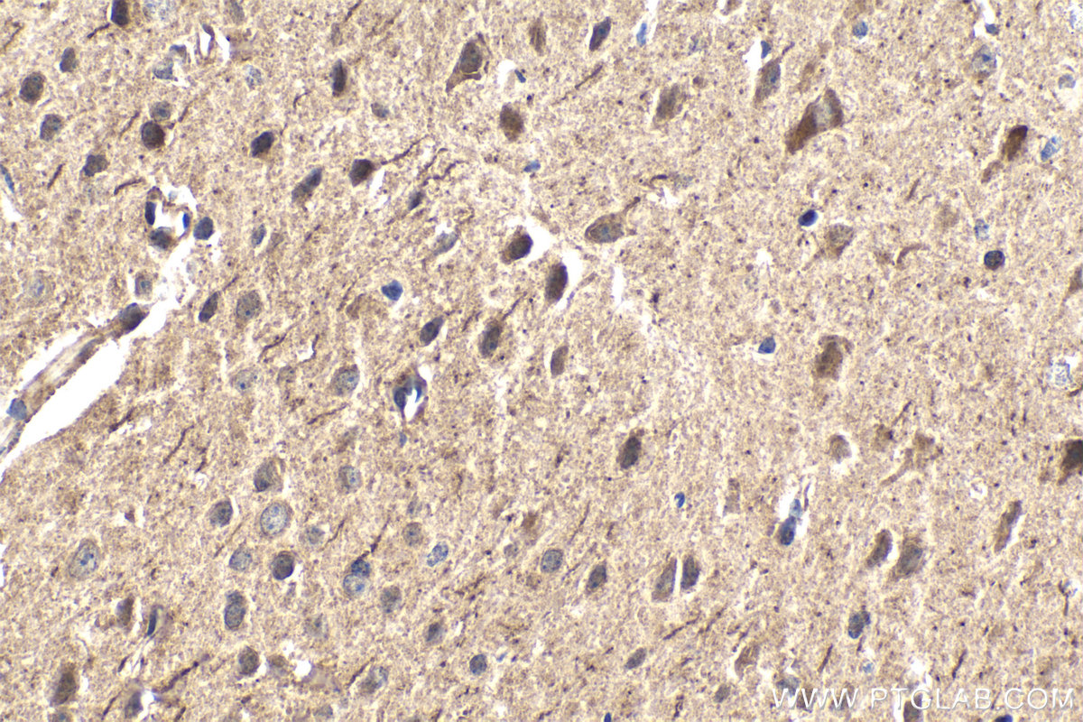 IHC staining of mouse brain using 16936-1-AP