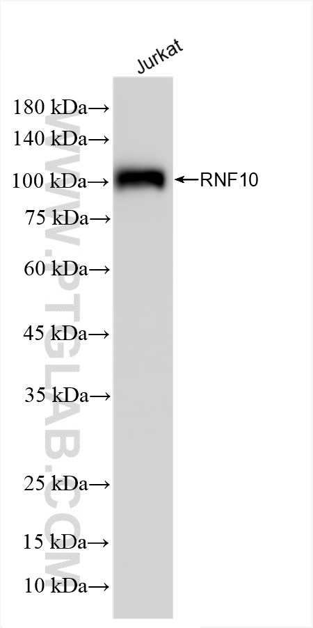 WB analysis of Jurkat using 86019-1-RR (same clone as 86019-1-PBS)
