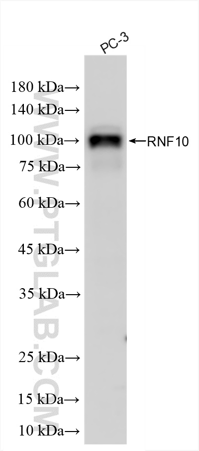 WB analysis of PC-3 using 86019-1-RR (same clone as 86019-1-PBS)