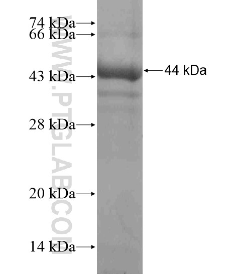 RNF112 fusion protein Ag18602 SDS-PAGE RNF112 fusion protein Ag18602 SDS-PAGE