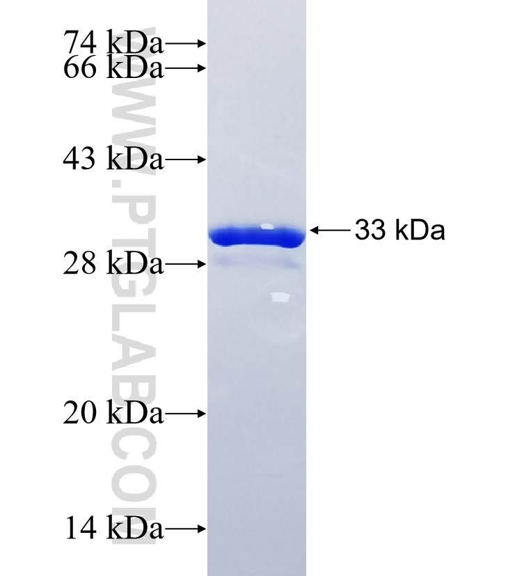 RNF113B fusion protein Ag22187 SDS-PAGE RNF113B fusion protein Ag22187 SDS-PAGE