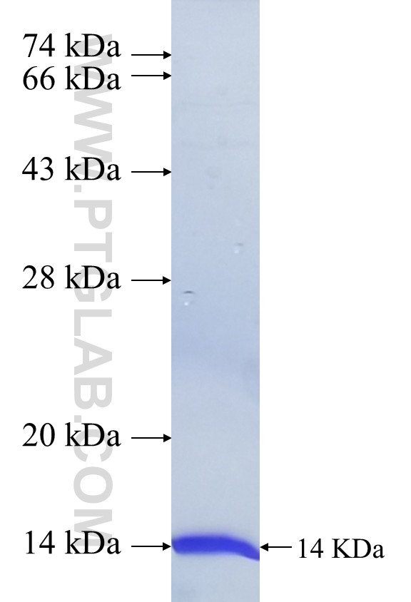 RNF113B fusion protein Ag39719 SDS-PAGE RNF113B fusion protein Ag39719 SDS-PAGE