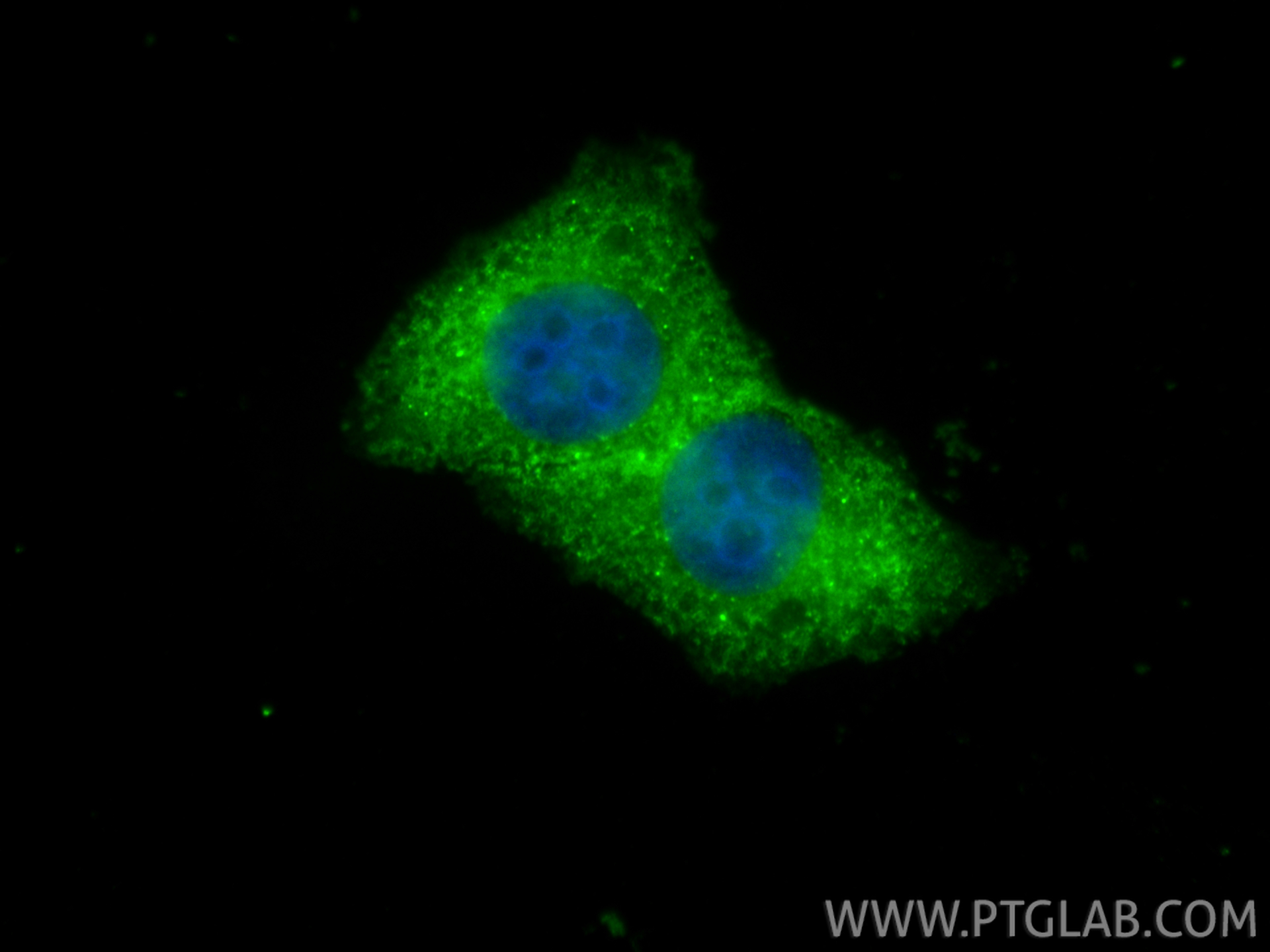 IF Staining of BGC-823 using 14338-1-AP IF Staining of BGC-823 using 14338-1-AP