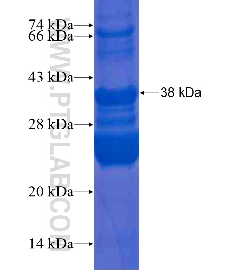 RNF115 fusion protein Ag20451 SDS-PAGE