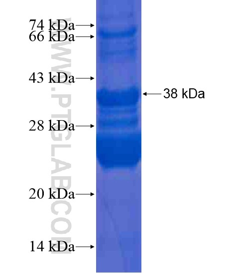 RNF115 fusion protein Ag20451 SDS-PAGE RNF115 fusion protein Ag20451 SDS-PAGE