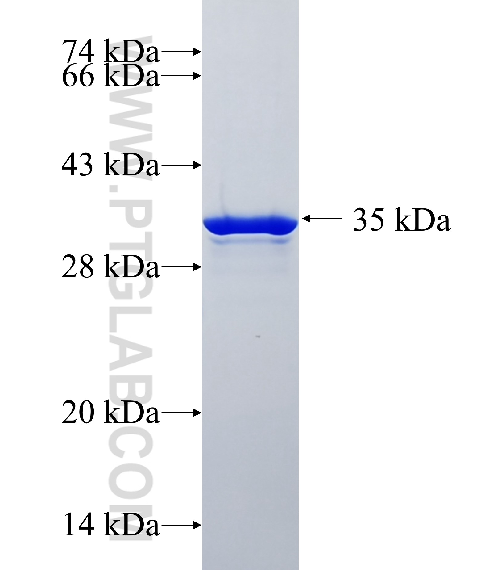RNF121 fusion protein Ag18938 SDS-PAGE RNF121 fusion protein Ag18938 SDS-PAGE