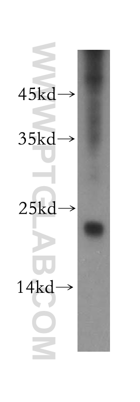 WB analysis of mouse spleen using 13290-1-AP