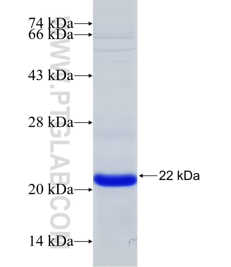 RNF125 fusion protein Ag31844 SDS-PAGE