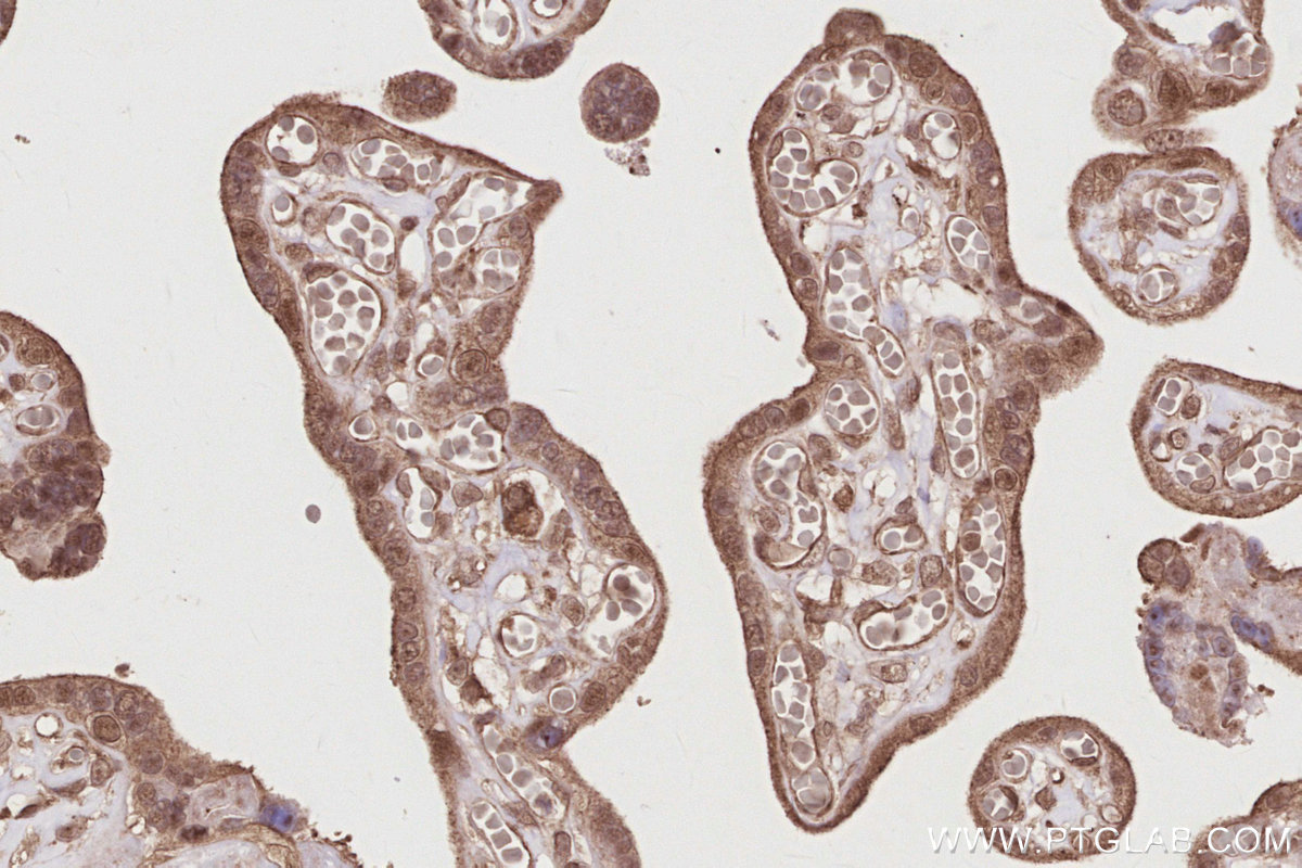IHC staining of human placenta using 19835-1-AP