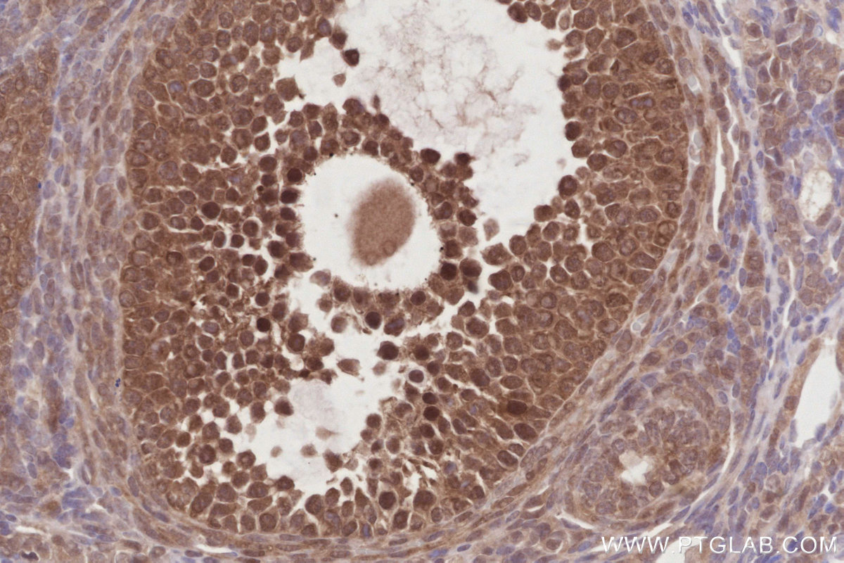 IHC staining of mouse ovary using 84772-6-RR (same clone as 84772-6-PBS)