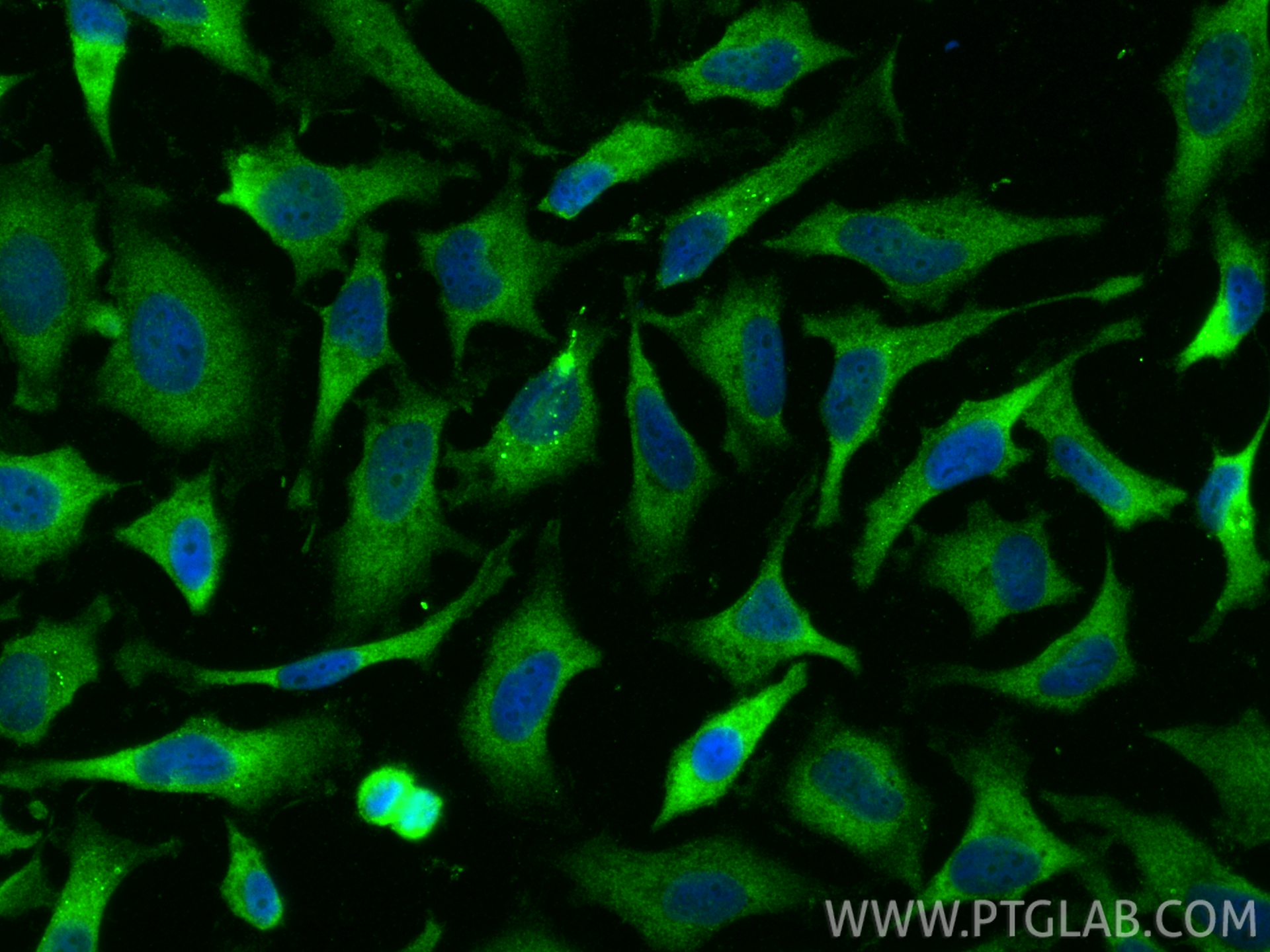 Immunofluorescent analysis of (-20°C Ethanol) fixed HeLa cells using RNF133 antibody (20792-1-AP) at dilution of 1:400 and CoraLite®488-Conjugated Goat Anti-Rabbit IgG(H+L) (<a class='green' href='/productredirect?CatalogNo=SA00013-2' target='_blank'>SA00013-2</a>). IF Staining of HeLa using 20792-1-AP