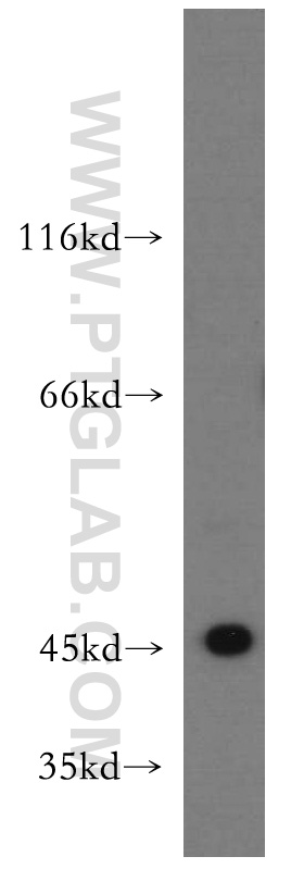 WB analysis of HeLa using 20792-1-AP