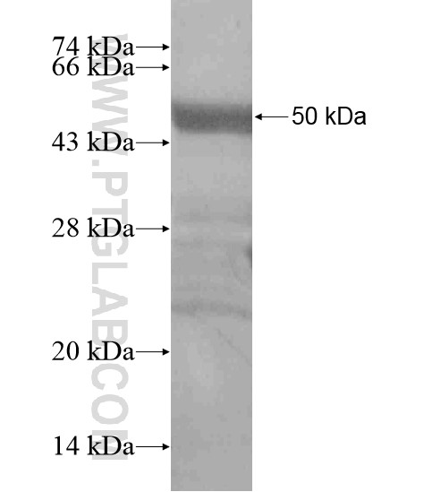 RNF135 fusion protein Ag18816 SDS-PAGE RNF135 fusion protein Ag18816 SDS-PAGE