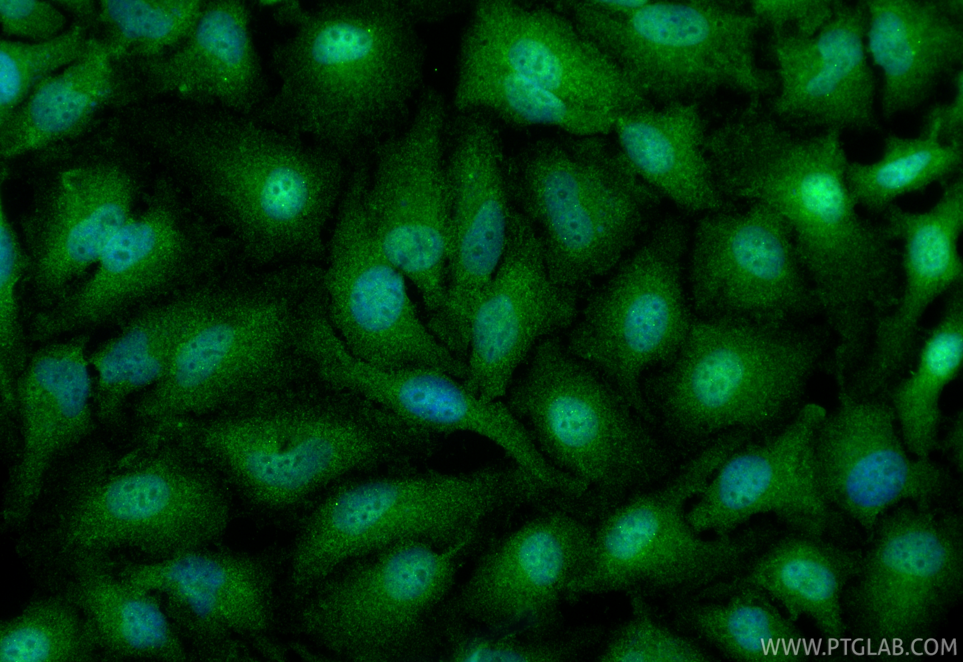 IF Staining of HeLa using 17039-1-AP IF Staining of HeLa using 17039-1-AP