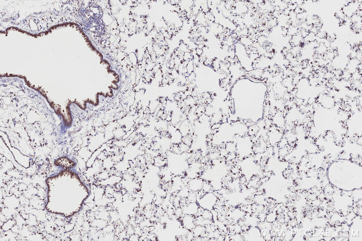 Immunohistochemical analysis of paraffin-embedded rat lung tissue slide using 28261-1-AP (RNF139 antibody) at dilution of 1:2000 (under 10x lens). Heat mediated antigen retrieval with Tris-EDTA buffer (pH 9.0). IHC staining of rat lung using 28261-1-AP