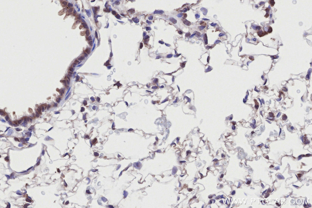 Immunohistochemical analysis of paraffin-embedded rat lung tissue slide using 28261-1-AP (RNF139 antibody) at dilution of 1:2000 (under 40x lens). Heat mediated antigen retrieval with Tris-EDTA buffer (pH 9.0). IHC staining of rat lung using 28261-1-AP