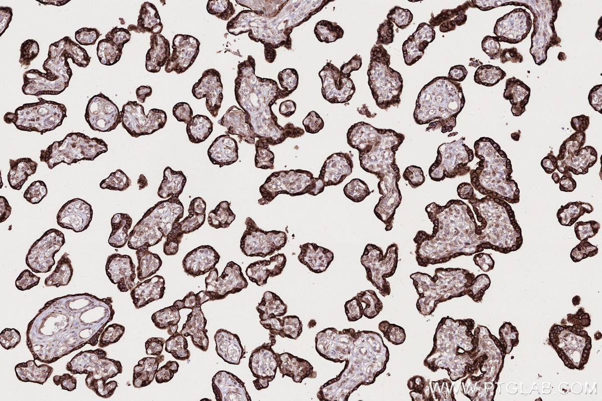 IHC staining of human placenta using 83755-2-RR IHC staining of human placenta using 83755-2-RR
