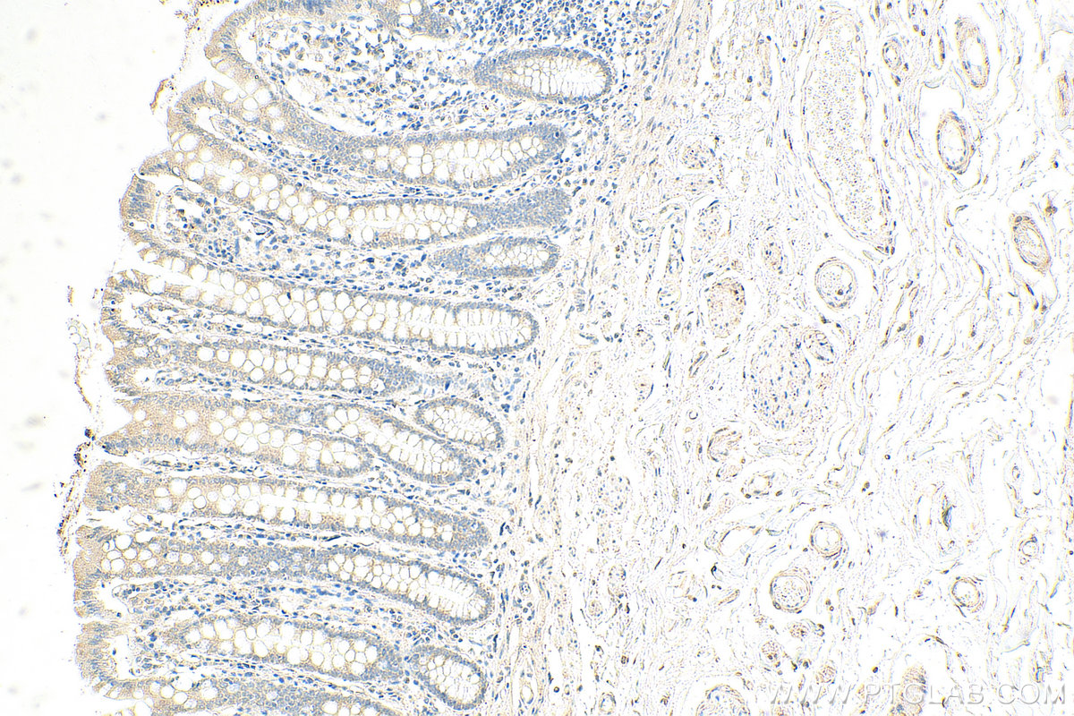 IHC staining of human colon using 26041-1-AP
