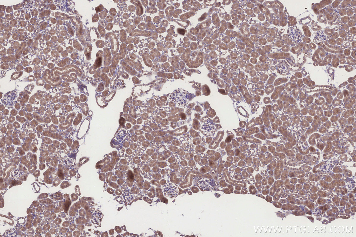 IHC staining of mouse kidney using 26306-1-AP IHC staining of mouse kidney using 26306-1-AP