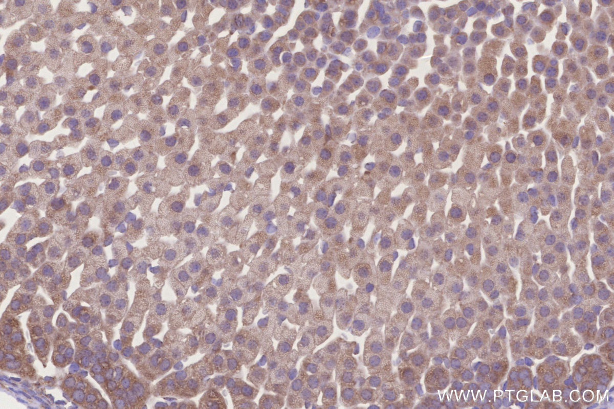 IHC staining of mouse adrenal gland using 26306-1-AP IHC staining of mouse adrenal gland using 26306-1-AP