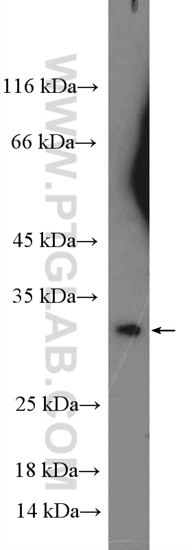 WB analysis of HeLa using 26306-1-AP