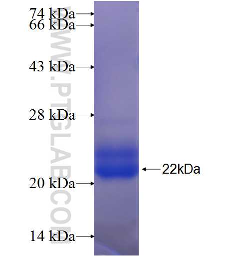 RNF144B fusion protein Ag24635 SDS-PAGE RNF144B fusion protein Ag24635 SDS-PAGE