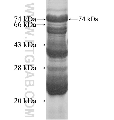 RNF146 fusion protein Ag14942 SDS-PAGE RNF146 fusion protein Ag14942 SDS-PAGE