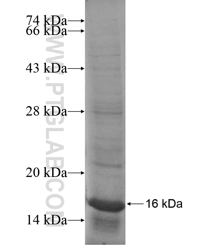 RNF150 fusion protein Ag16989 SDS-PAGE RNF150 fusion protein Ag16989 SDS-PAGE