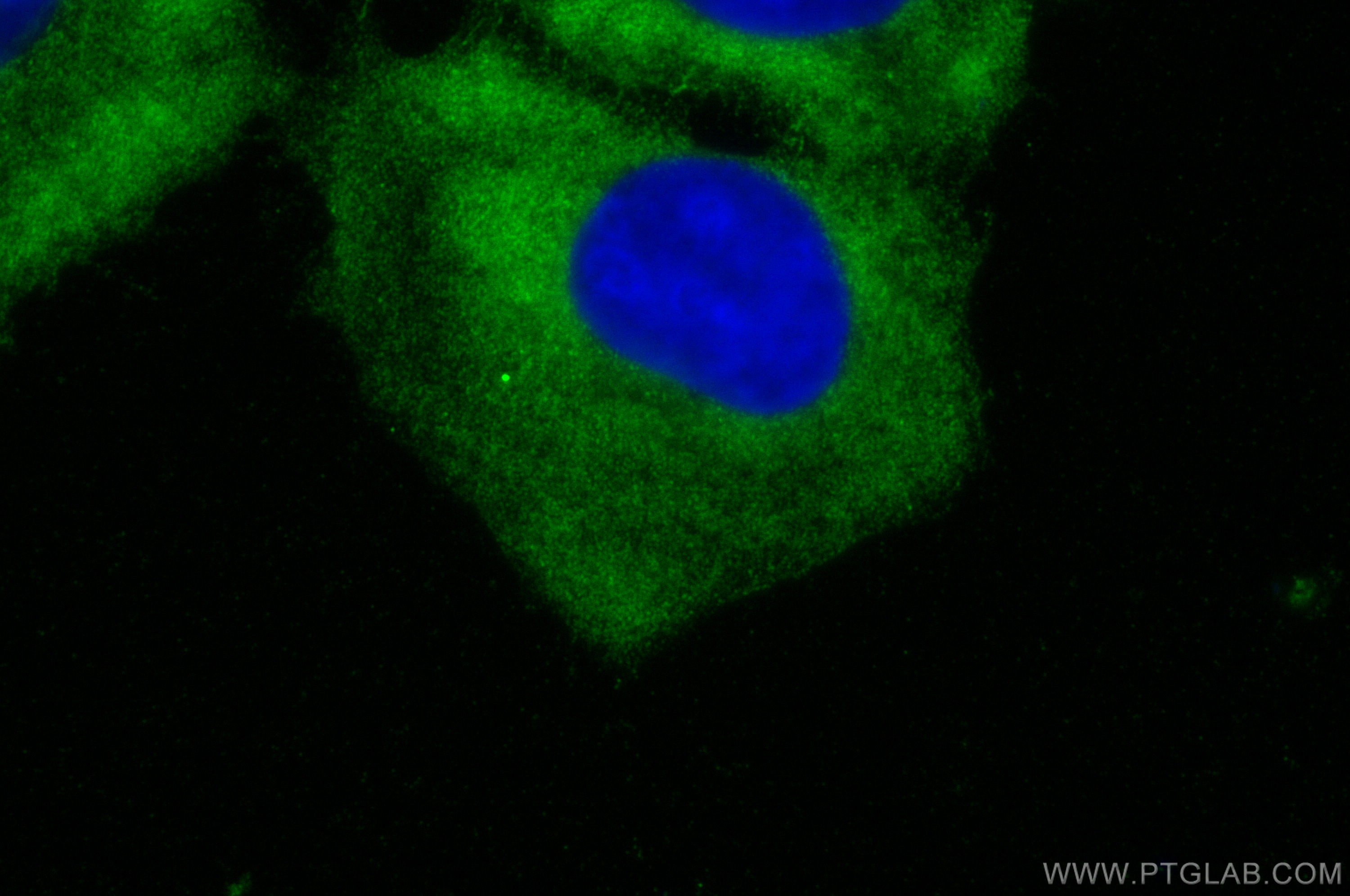 IF Staining of U2OS using 28452-1-AP