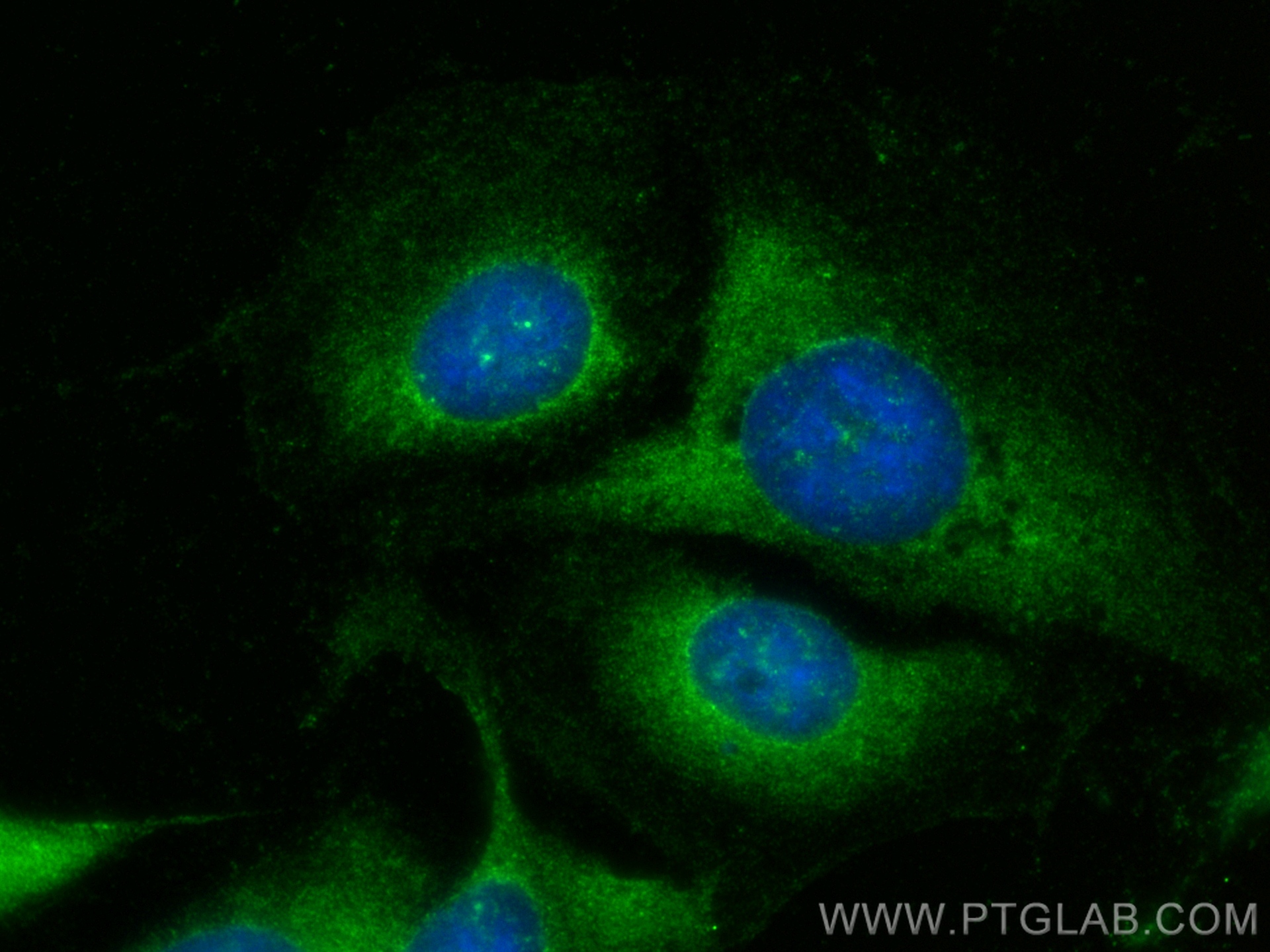 Immunofluorescent analysis of (-20°C Ethanol) fixed U2OS cells using RNF160 antibody (28452-1-AP) at dilution of 1:400 and CoraLite®488-Conjugated Goat Anti-Rabbit IgG(H+L) (<a class='green' href='/productredirect?CatalogNo=SA00013-2' target='_blank'>SA00013-2</a>). IF Staining of U2OS using 28452-1-AP