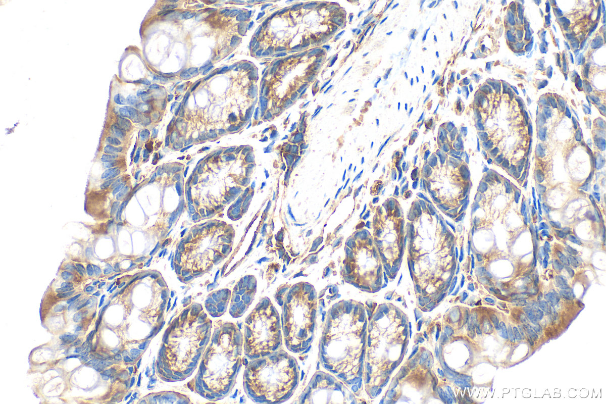 Immunohistochemical analysis of paraffin-embedded mouse colon tissue slide using 28452-1-AP (RNF160 antibody) at dilution of 1:200 (under 40x lens). Heat mediated antigen retrieval with Tris-EDTA buffer (pH 9.0). IHC staining of mouse colon using 28452-1-AP