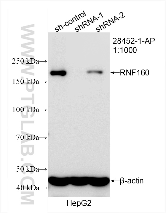 WB analysis of HepG2 using 28452-1-AP