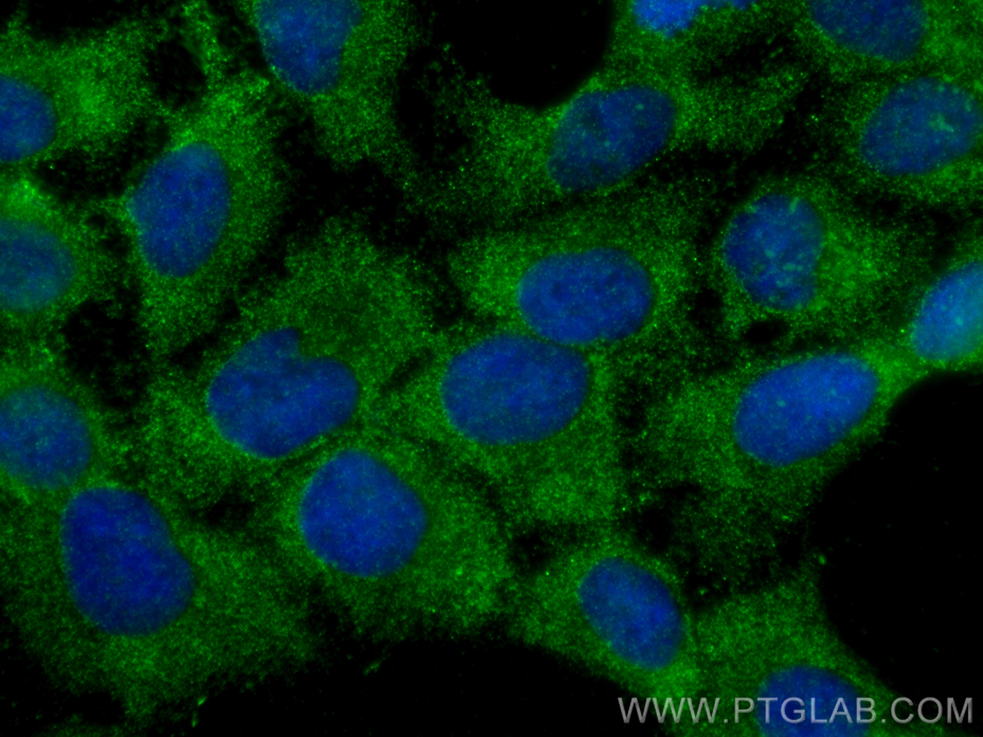 IF Staining of HaCaT using 24618-1-AP