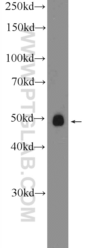 WB analysis of SH-SY5Y using 24618-1-AP