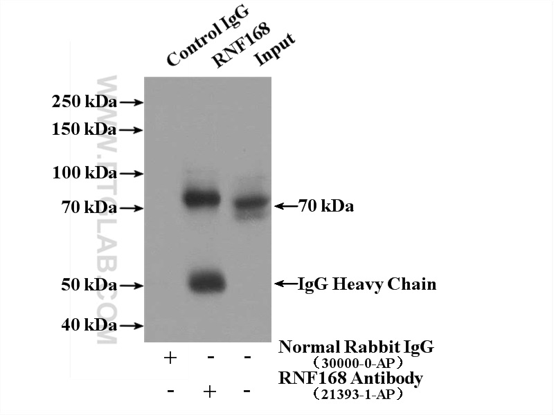 IP experiment of HepG2 using 21393-1-AP