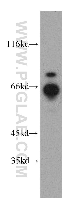 WB analysis of HepG2 using 21393-1-AP