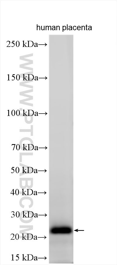 WB analysis using 21024-1-AP WB analysis using 21024-1-AP