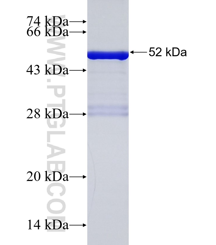 RNF180 fusion protein Ag34138 SDS-PAGE
